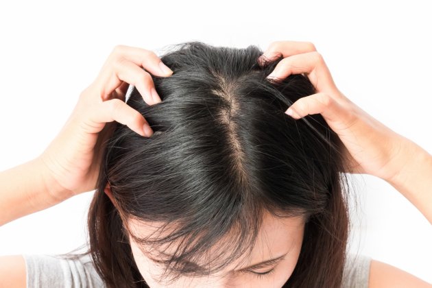Cheveux qui démangent : quelles en sont les causes ?